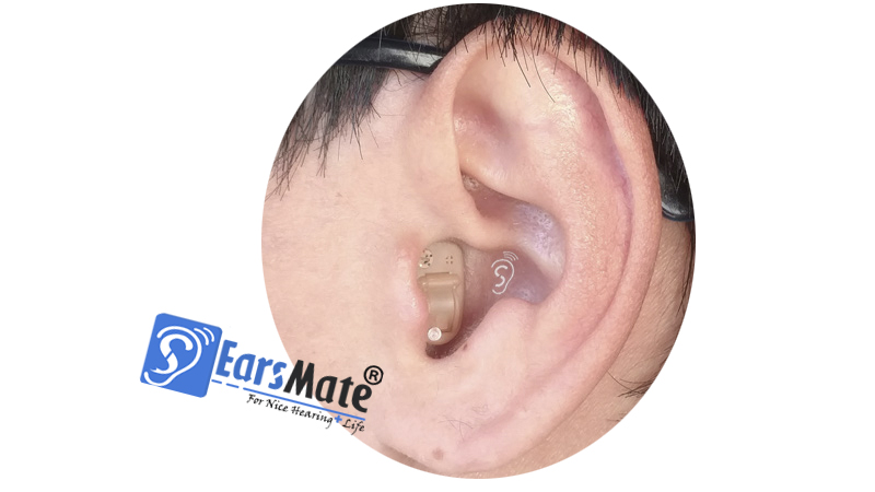 Nuevos audífonos digitales invisibles ocultos en el oído